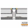 درز انبساط الاستوبلاک